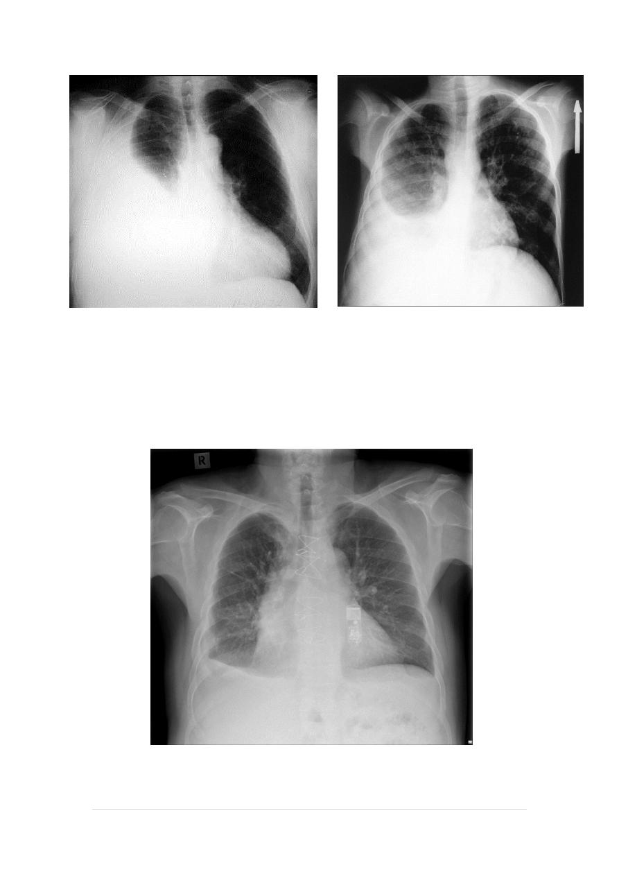 Chest Imaging pdf - Chest Imaging - Muhadharaty