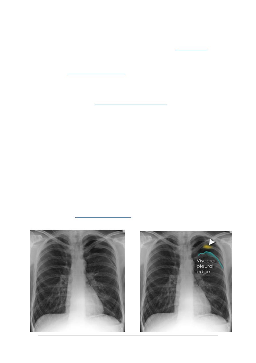 Chest Imaging pdf - Chest Imaging - Muhadharaty