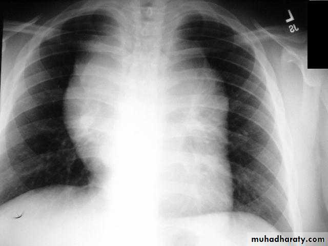 Chest Imaging pptx - Chest Imaging - Muhadharaty