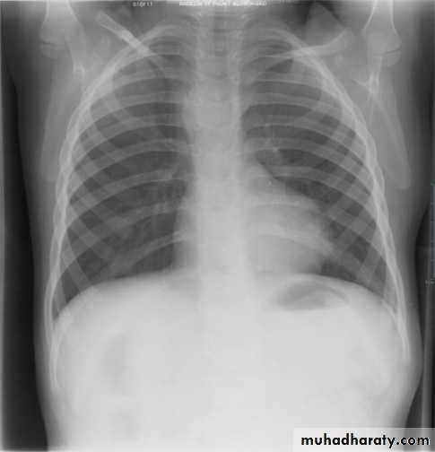 Chest Imaging pptx - Chest Imaging - Muhadharaty