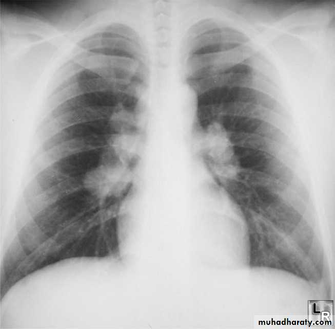 Chest Imaging Docx - Chest Imaging - Muhadharaty