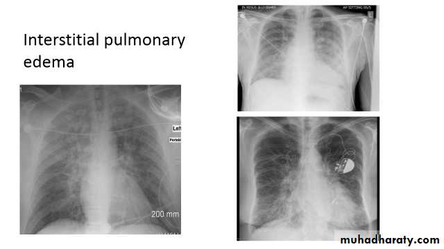 Chest Imaging docx - Chest Imaging - Muhadharaty