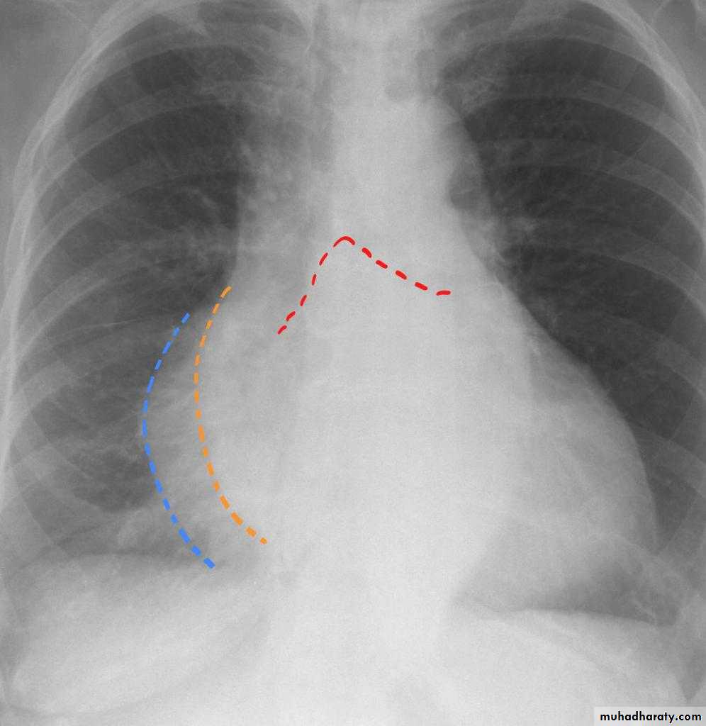 Chest Imaging docx - Chest Imaging - Muhadharaty