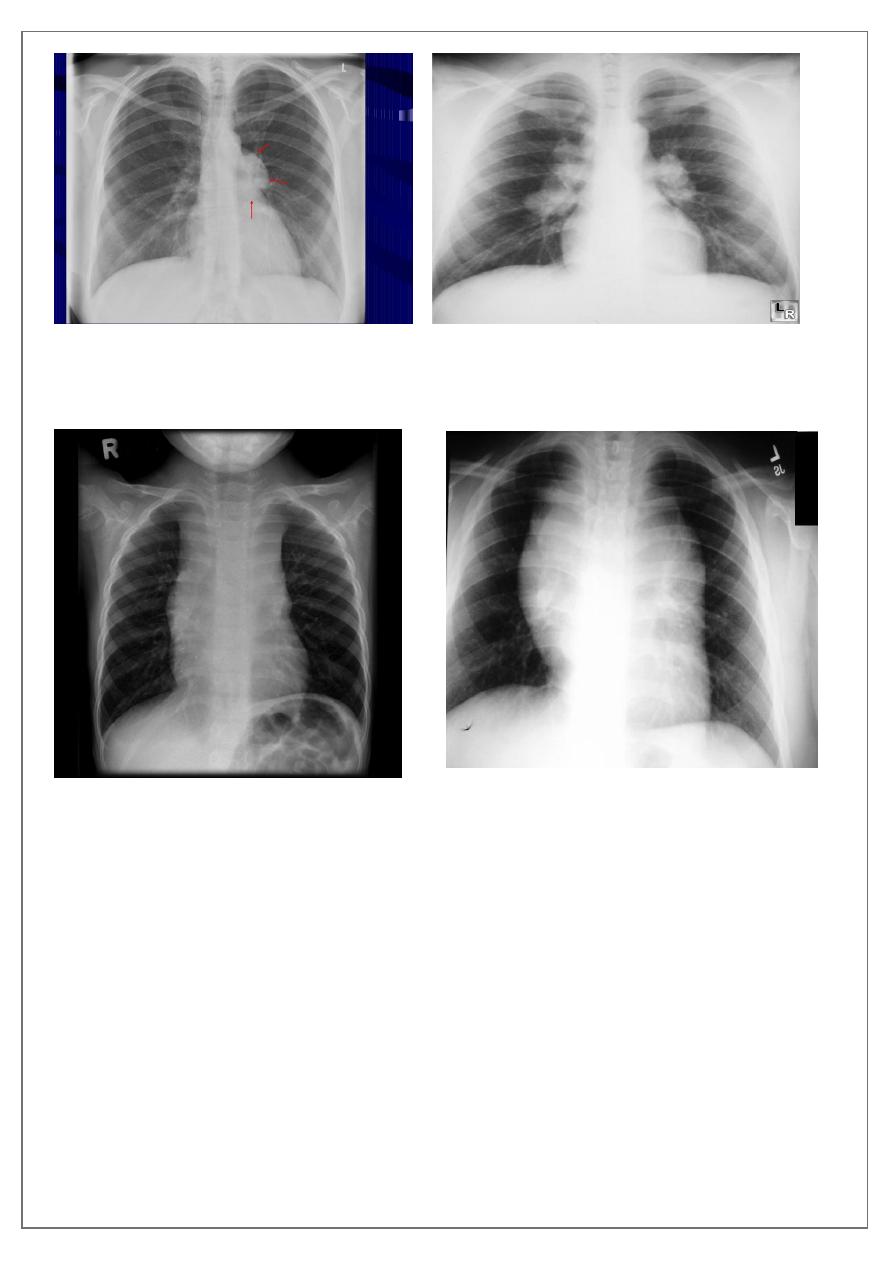 Chest Imaging pdf - Chest Imaging - Muhadharaty