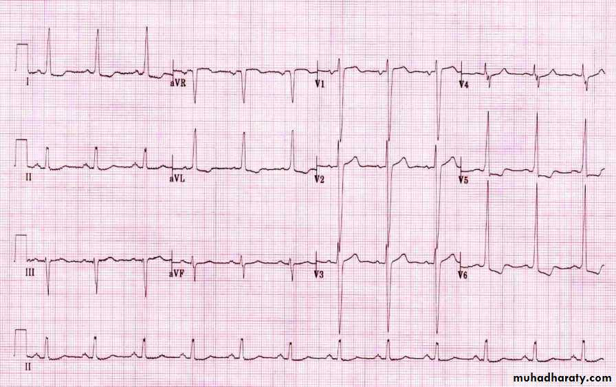 Cardio L2 Docx - د. حسين الجنابي - Muhadharaty