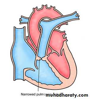 Valvular heart diseases pptx - د. محمد سعيد - Muhadharaty