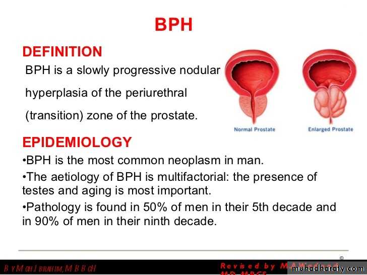 urology-pptx-group-a-muhadharaty