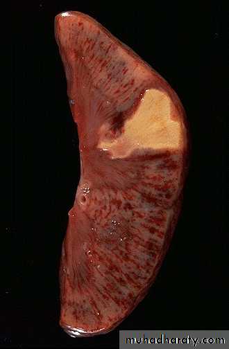 Hemodynamic Disorders pptx - D. Maha - Muhadharaty