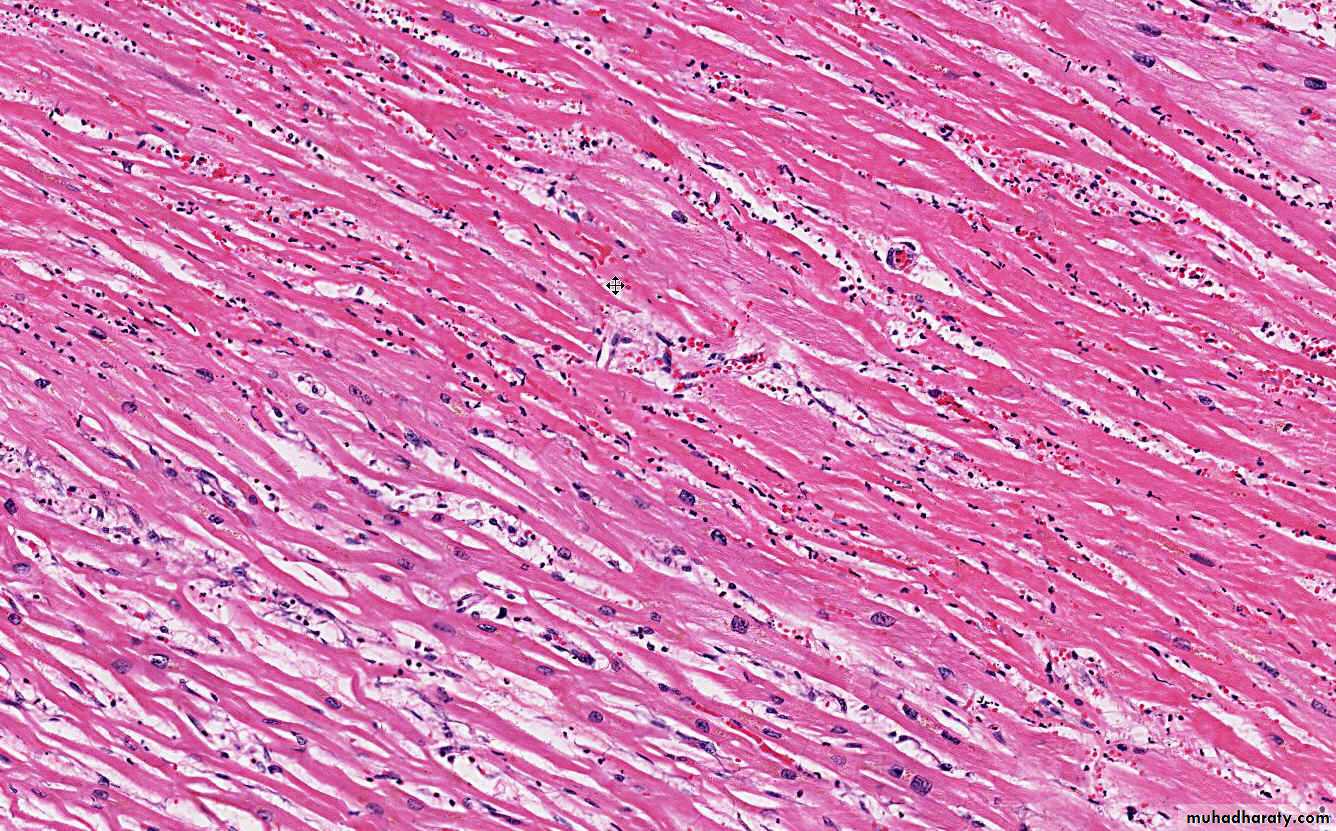 Hemodynamic Disorders pptx - D. Maha - Muhadharaty