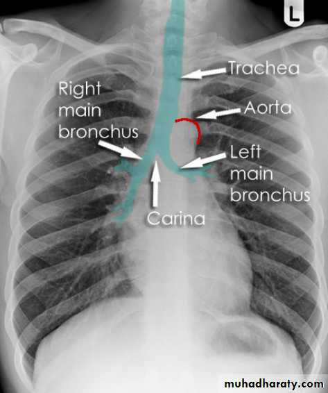 chest pptx - AB - Muhadharaty