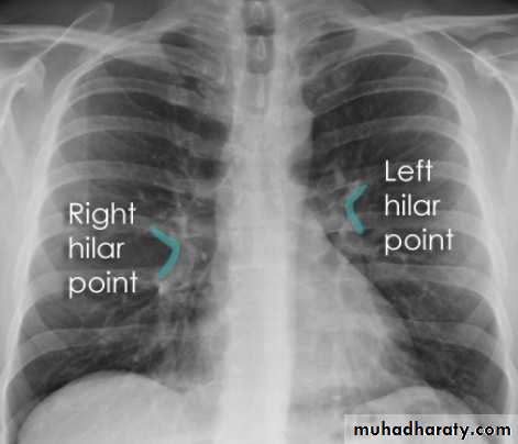 chest pptx - AB - Muhadharaty