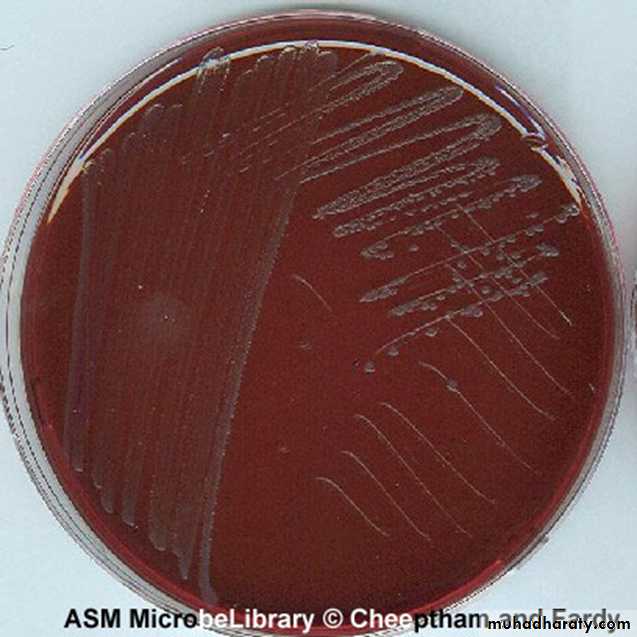 C-Eosin Methylene Blue (EMB) agar.