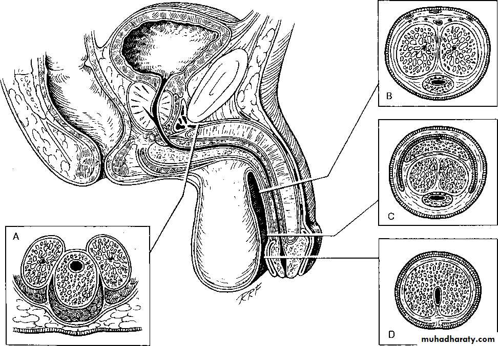 Urethra inury and hypospadias final ppsx . urinary