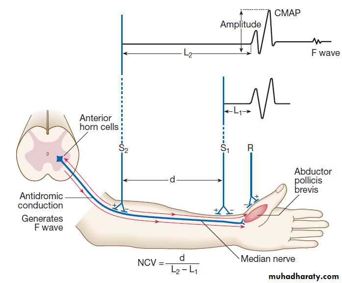 Neurological disease pptx - د. حسين محمد جمعة - Muhadharaty