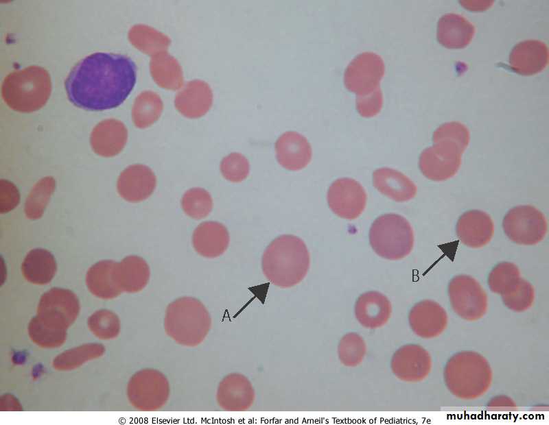 HA Docx - Haematology - Muhadharaty