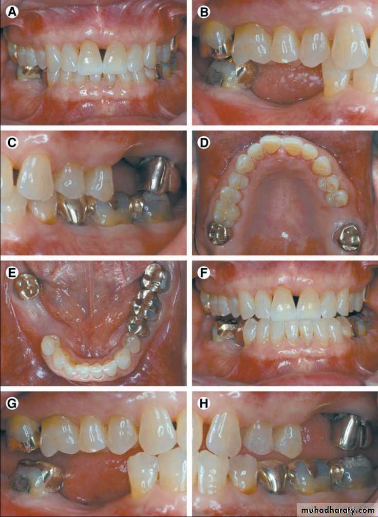 3 pptx - Dr. Karam - Muhadharaty