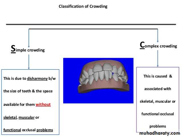 Cl I Malocclusion Pptx Dr Alaa Muhadharaty