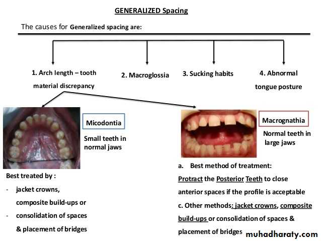 Cl I Malocclusion pptx - Dr. Alaa - Muhadharaty