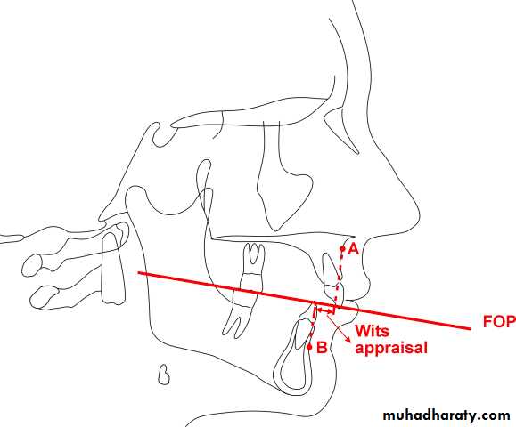 4 pptx - Dr. Omer Ali - Muhadharaty