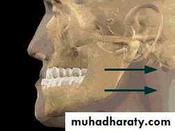 Orthognathic Surgery Pptx - Dr. Alaa - Muhadharaty