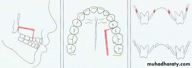 Orthognathic Surgery Pptx - Dr. Alaa - Muhadharaty