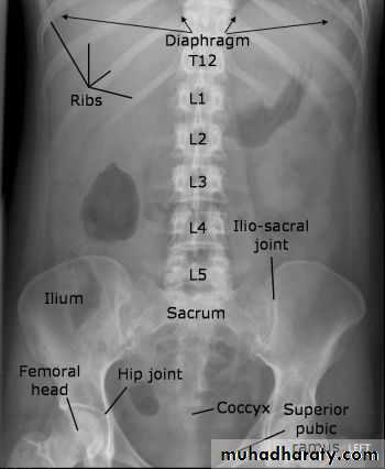 HOW TO READ AN ABDOMINAL X-RAY ppsx - د. عبد اللطيف البياتي - Muhadharaty