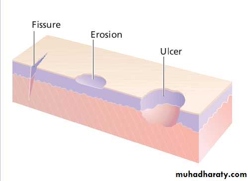 diagnosis of skin diseases ppt pptx - د. وسام اللامي - Muhadharaty