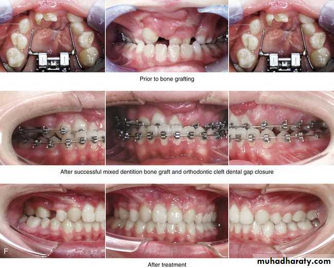 Orthodontic Introduction Pptx - د.أسيل - Muhadharaty