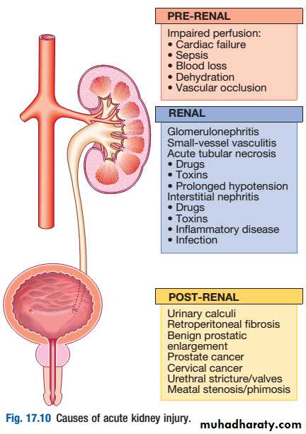 acute-renal-failure-pptx-muhadharaty