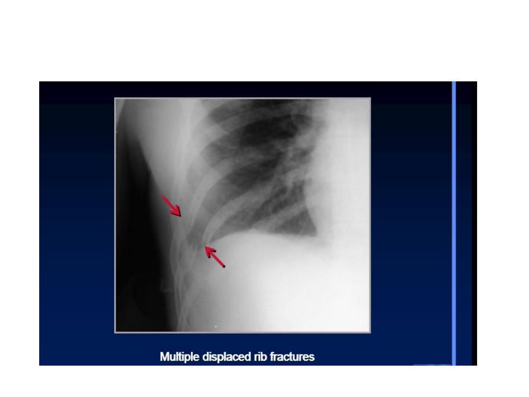 classification-of-thoracic-trauma-download-scientific-diagram