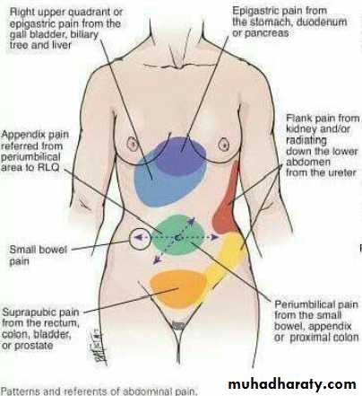 Flank pain radiating to the suprapubic region