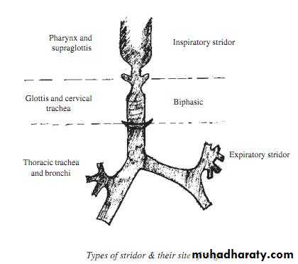 Stridor Pptx - د.فالح - Muhadharaty