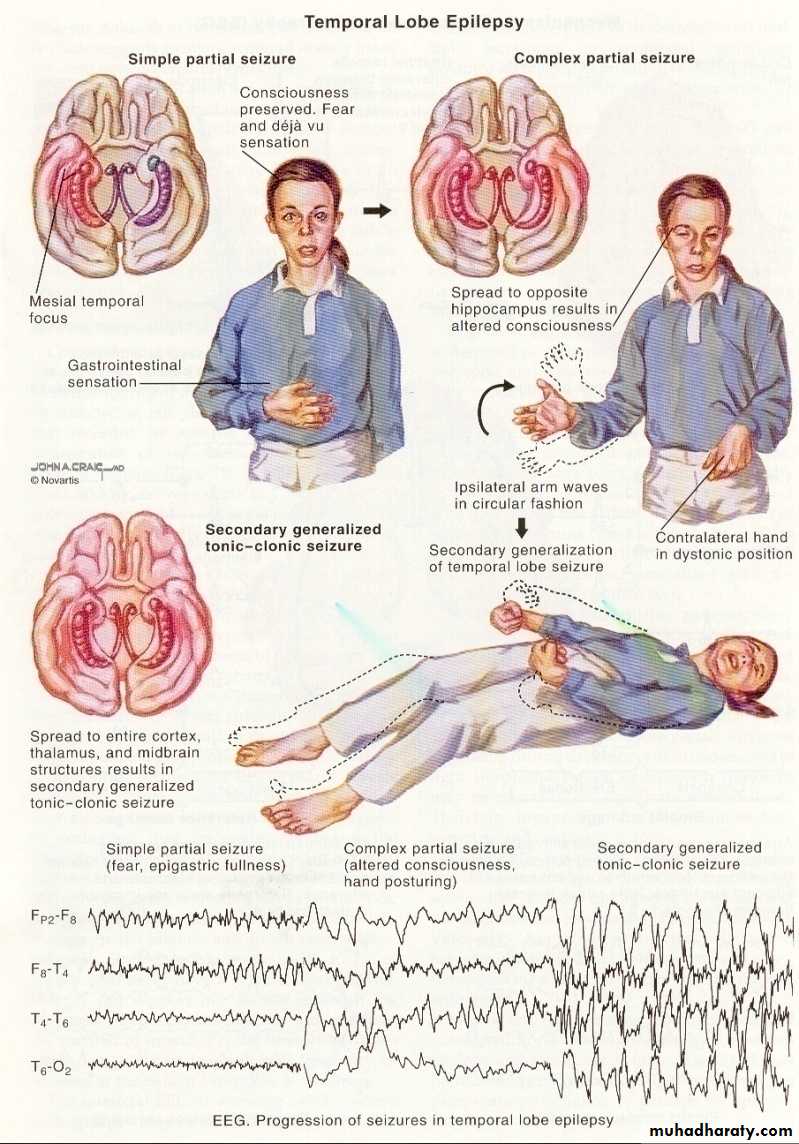 Diagnosis and Treatment Planning for RPD pptx - د.رضوان - Muhadharaty