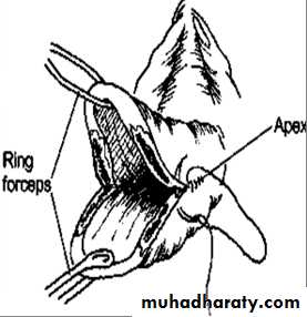 Obstetrics injuries pptx - د.سجى - Muhadharaty