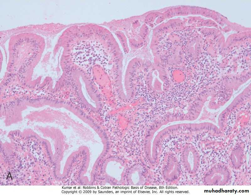 liver pptx - د.زينب - Muhadharaty