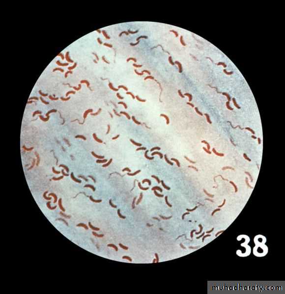  Vibrio  cholerae pptx   Muhadharaty