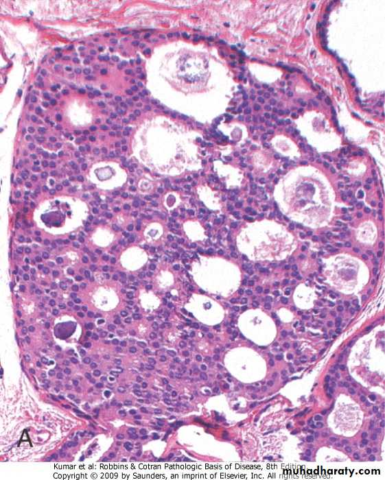 Breast pptx - د.سرى - Muhadharaty