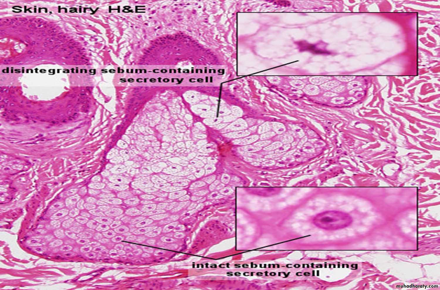 Skin pptx - د. رنا مصطفى - Muhadharaty