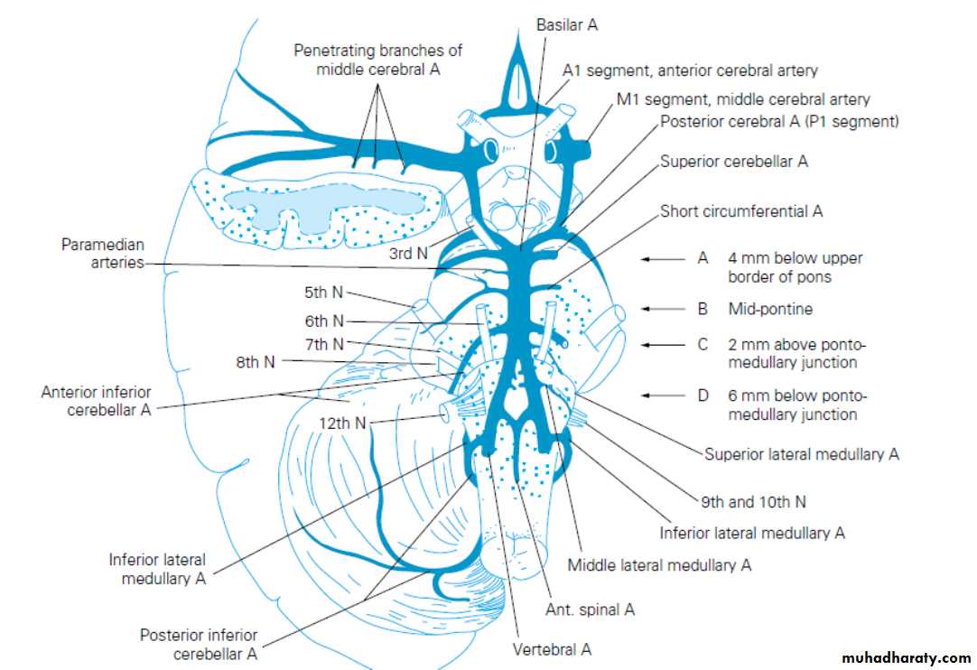 Stroke docx - سمنارات كروب A - Muhadharaty