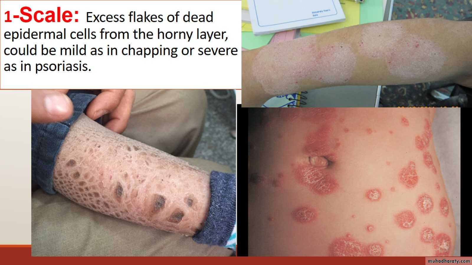 diagnosis-of-skin-diseases-pptx-d-hadf-muhadharaty-images-and-photos