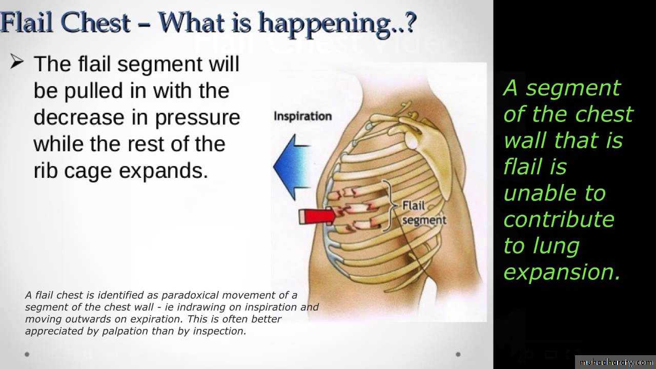 Chest trauma pptx D. Usama Muhadharaty