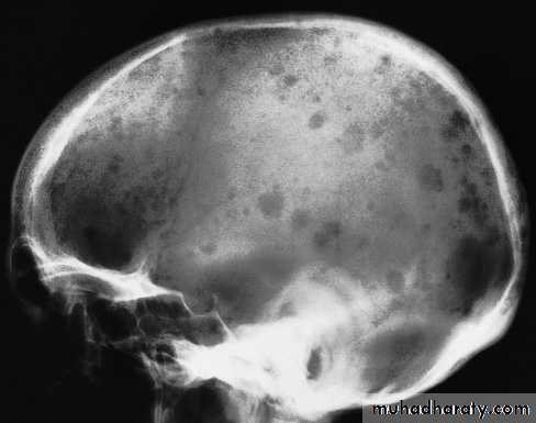 Skull X-Rays pptx - D. Firas - Muhadharaty