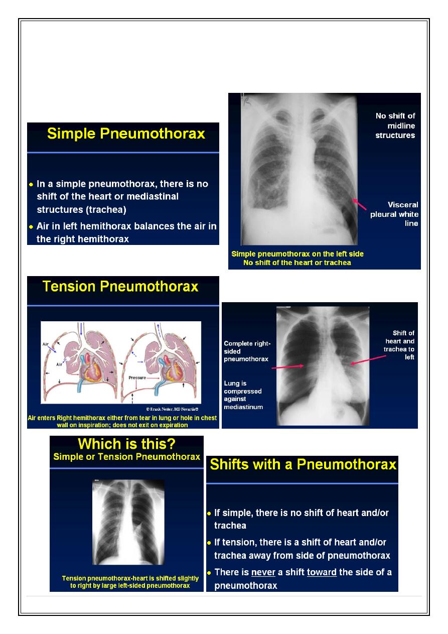 Pleura pdf - D. Riyadh - Muhadharaty