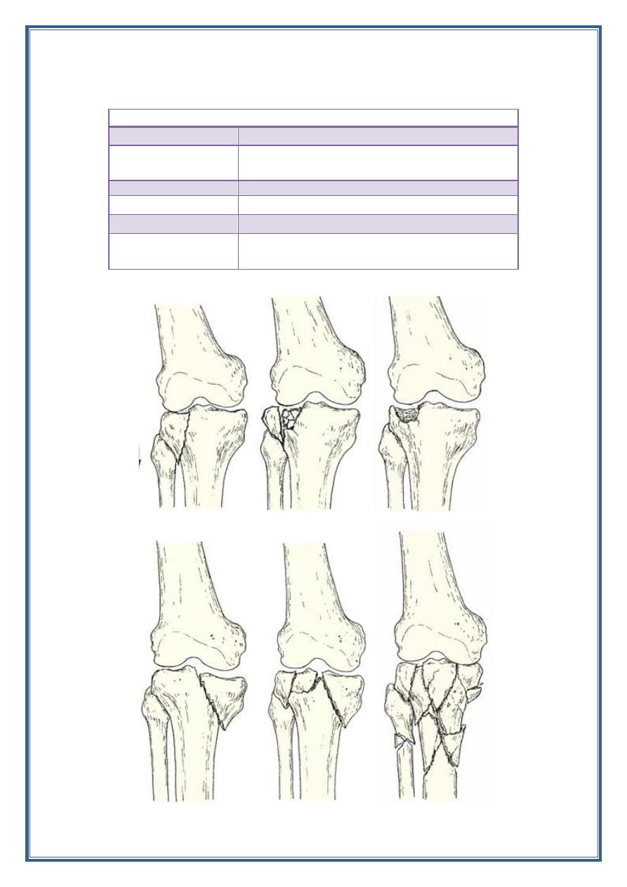 Lower Limb Fractures Pdf - D. Khalid - Muhadharaty