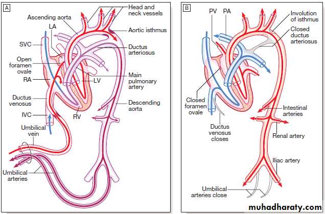 congenital heart disease and infective endocarditis pptx - شكري ...