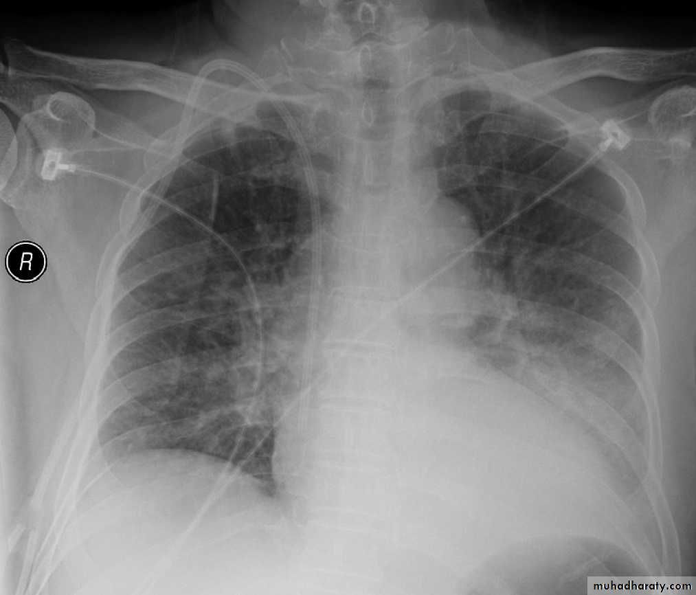 Legionella pneumophila pptx - د.علي عباس - Muhadharaty