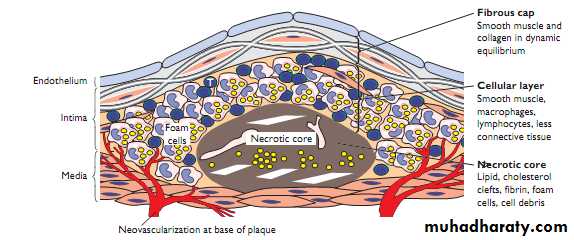 Blood vessels pathology pptx - د. زهراء - Muhadharaty