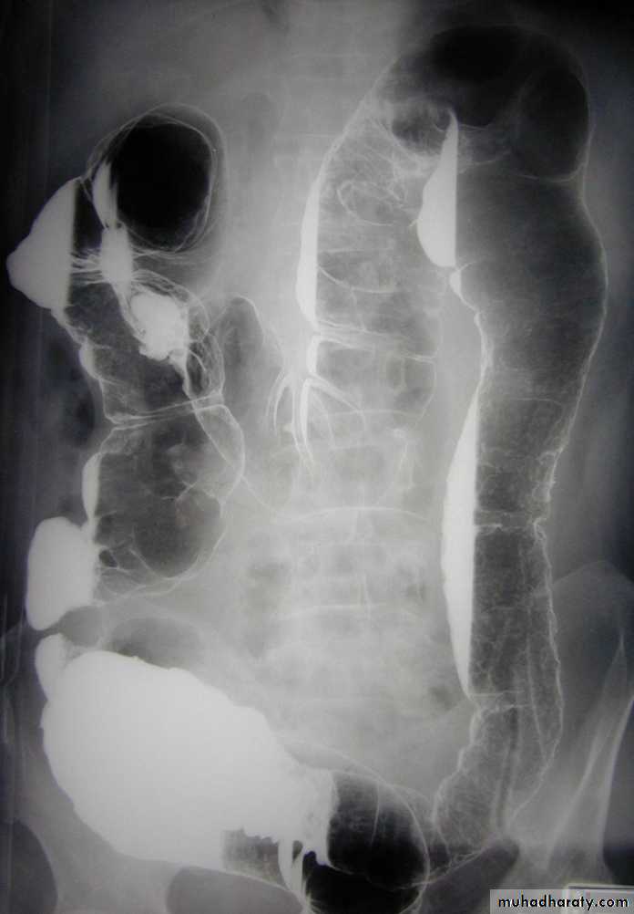 Gastrointestinal Radiology Pptx - د. وسن - Muhadharaty