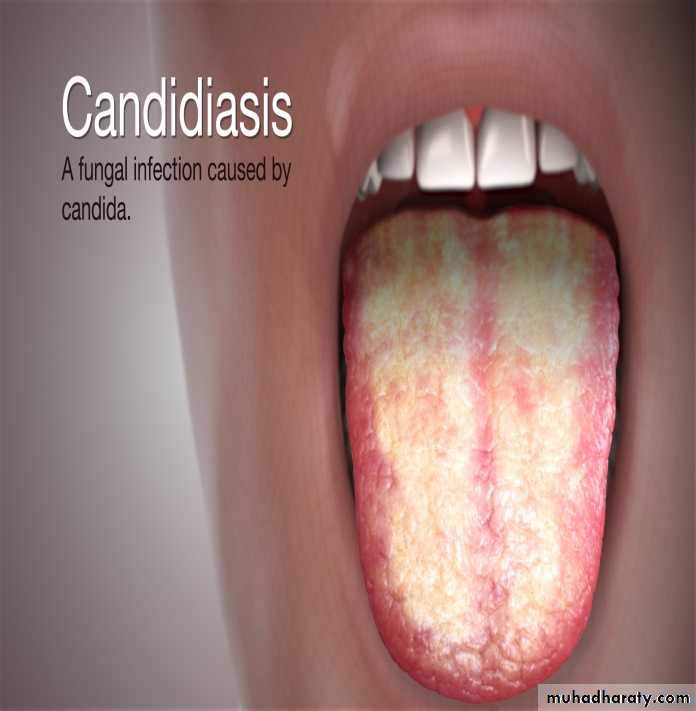 FUNGAL INFECTION 2 pptx - د. أنفال - Muhadharaty