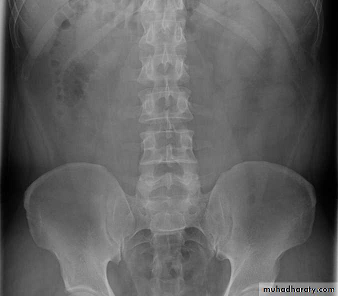 Urinary system 3 pptx - د. أحمد - Muhadharaty